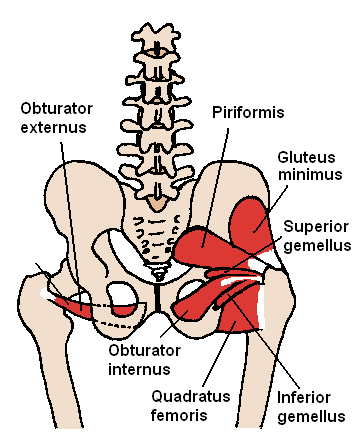 Sciatica